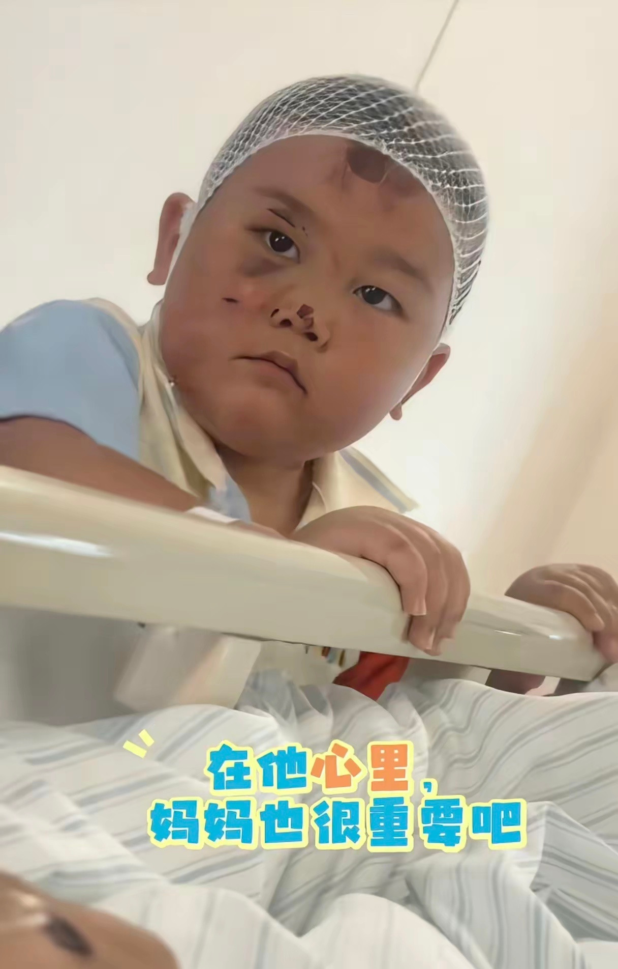 这母子真是过命的交情！车祸后一脸伤的3岁男孩，喂妈妈吃饭时奶凶的眼神，担心妈妈不