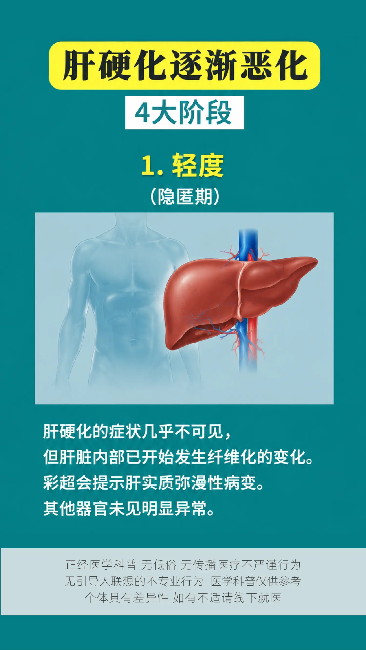 肝硬化逐渐恶化，4大阶段。