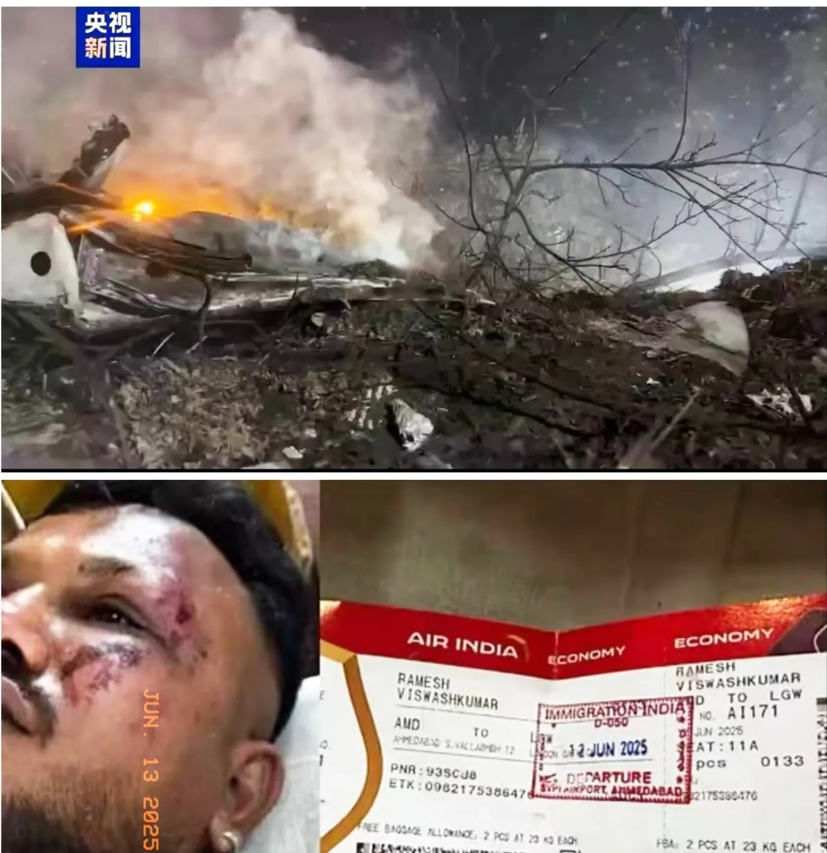 印度空难唯一幸存者！他靠紧急出口捡回一命，醒来第一句话让人泪崩“轰