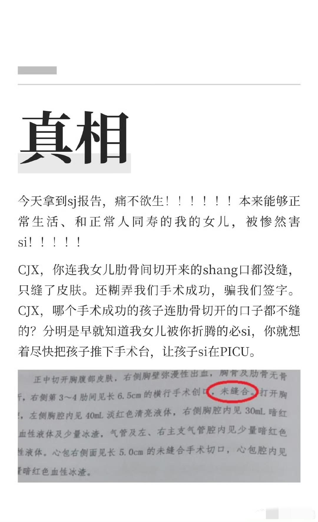 s检报告出来了，每一条都挑战人的下限！1、没有所谓的7mm房缺，没有症状，