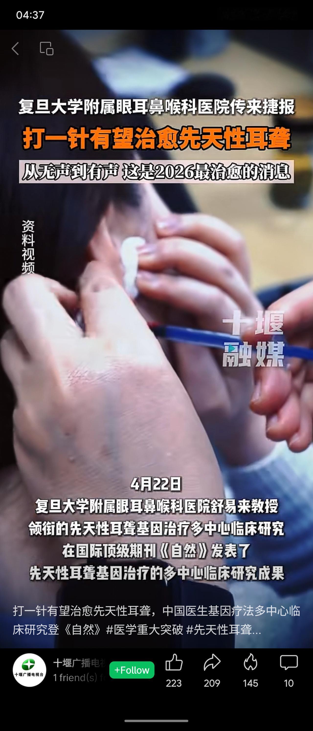 复旦大学附属眼耳鼻喉科医院舒易来教授团队在《自然》发表先天性耳聋基因治疗多中心临