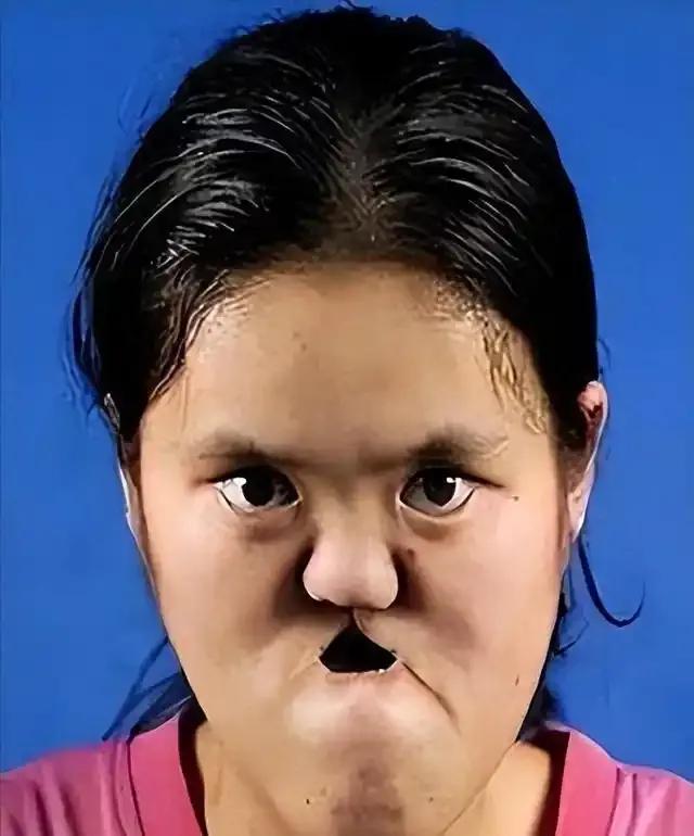 1990年，陕西一老农捡到一个没有嘴巴和鼻子的女婴，为了将其抚养长大，将自己的亲