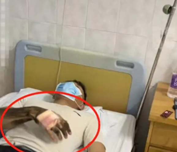 最该配蛇毒血清的就是基层！昨天报道，漯河男子放生蝮蛇被咬，救助中心隔10分钟打一