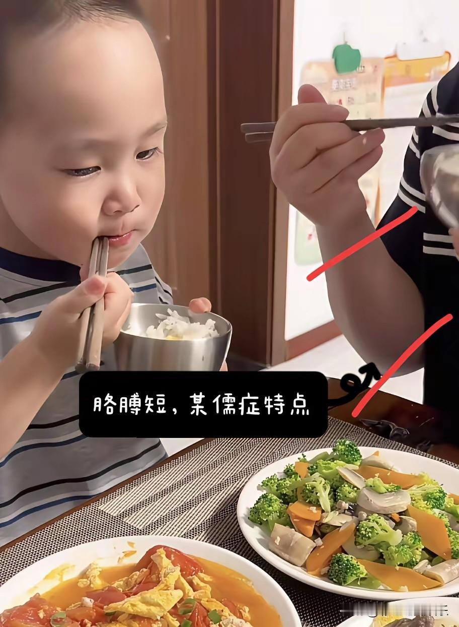 米乐妈妈把胳膊p得不一样长，事出反常必有妖，听说只有侏儒的胳膊才短，她家门把手也