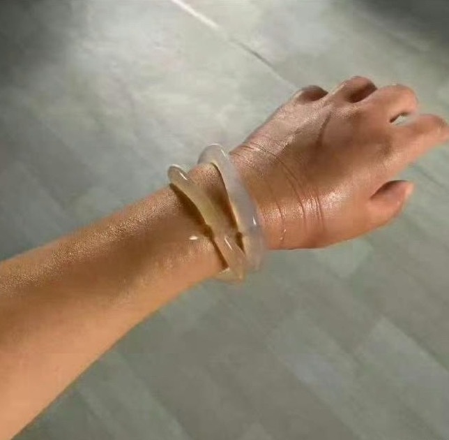老婆的手镯取不下来了，该怎么办才好？​​​