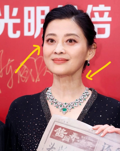 50岁的梅婷有个很大的问题难道你们没有发现吗？那就是她的脸上一点医美的痕迹也