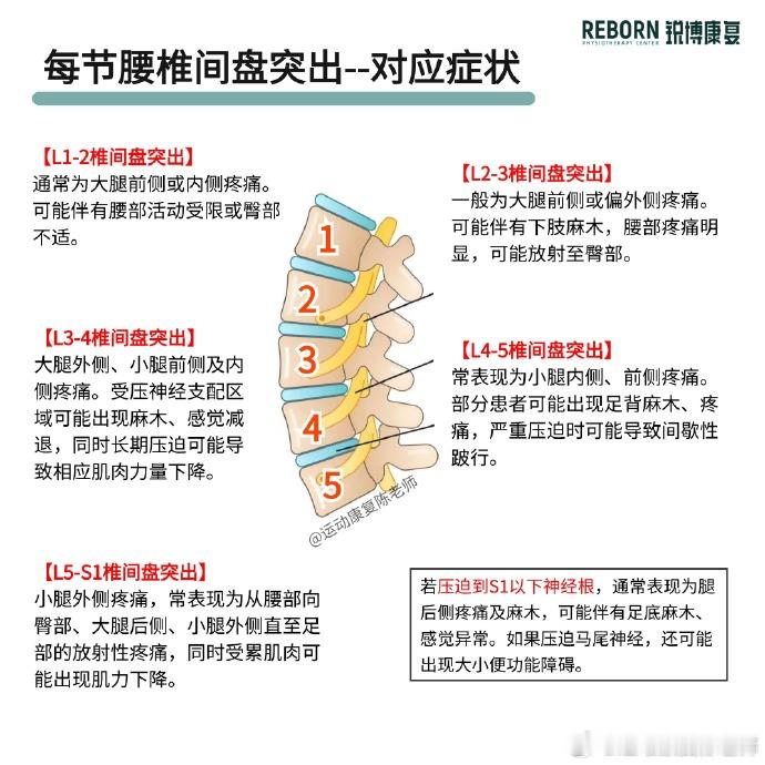 一个视频讲清楚腰椎间盘突出昨天发了腰突的科普视频，今天再给大家看看这张图：不