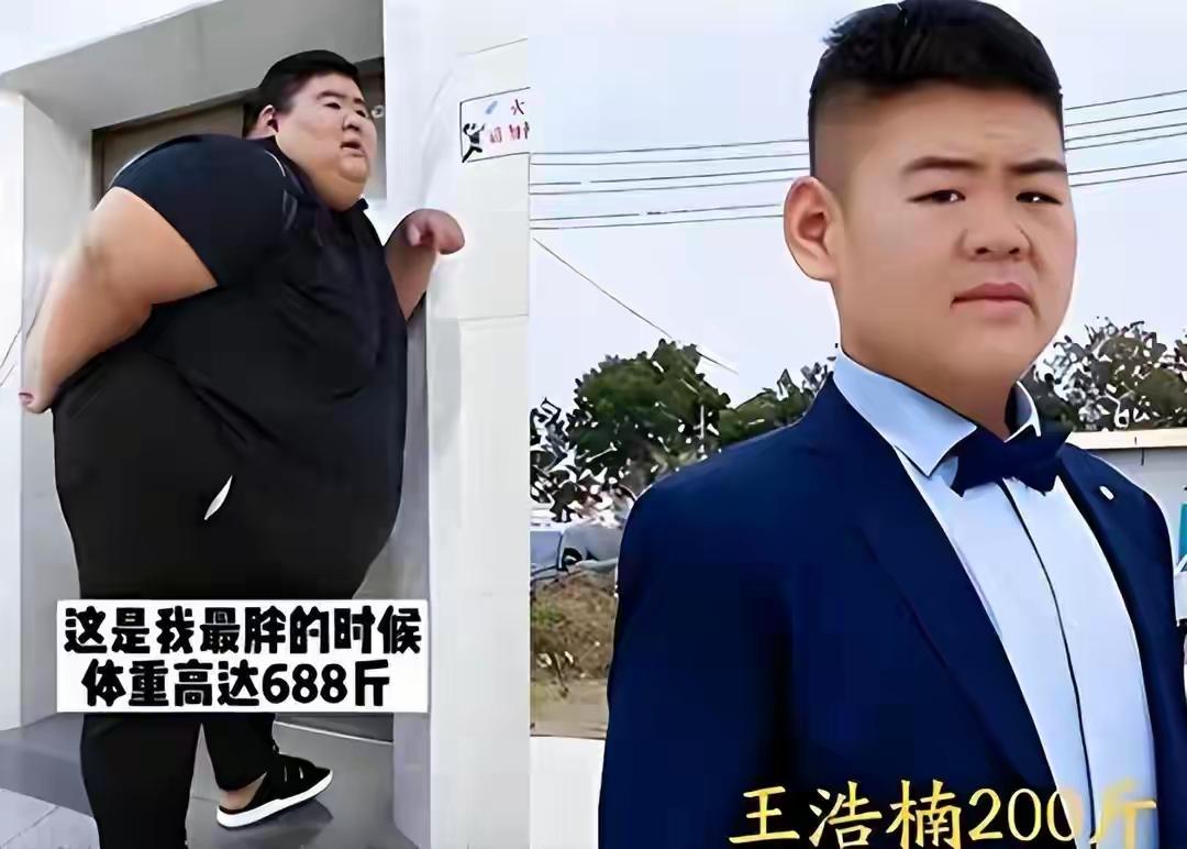 山东“中国首胖”切胃暴瘦480斤娶娇妻，成名后出轨持刀威胁原配，如今反弹300斤