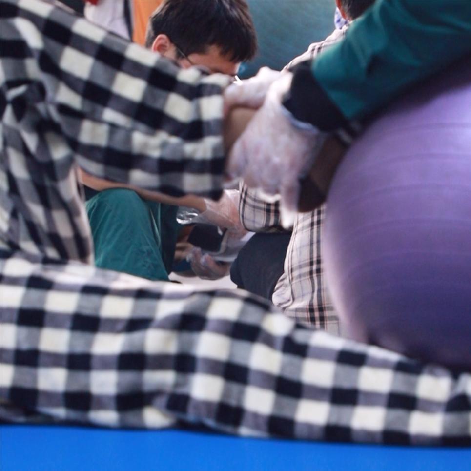 脊髓损伤后下肢出现这三个状况，一定要当心！1.大腿酸胀疼痛很多朋友都会遇到这