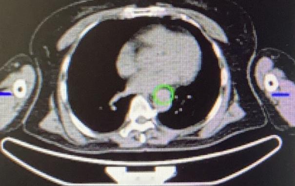 门诊一位65岁的农村阿姨，真的特别有健康意识！虽然身体一直挺硬朗，但她每年都会主