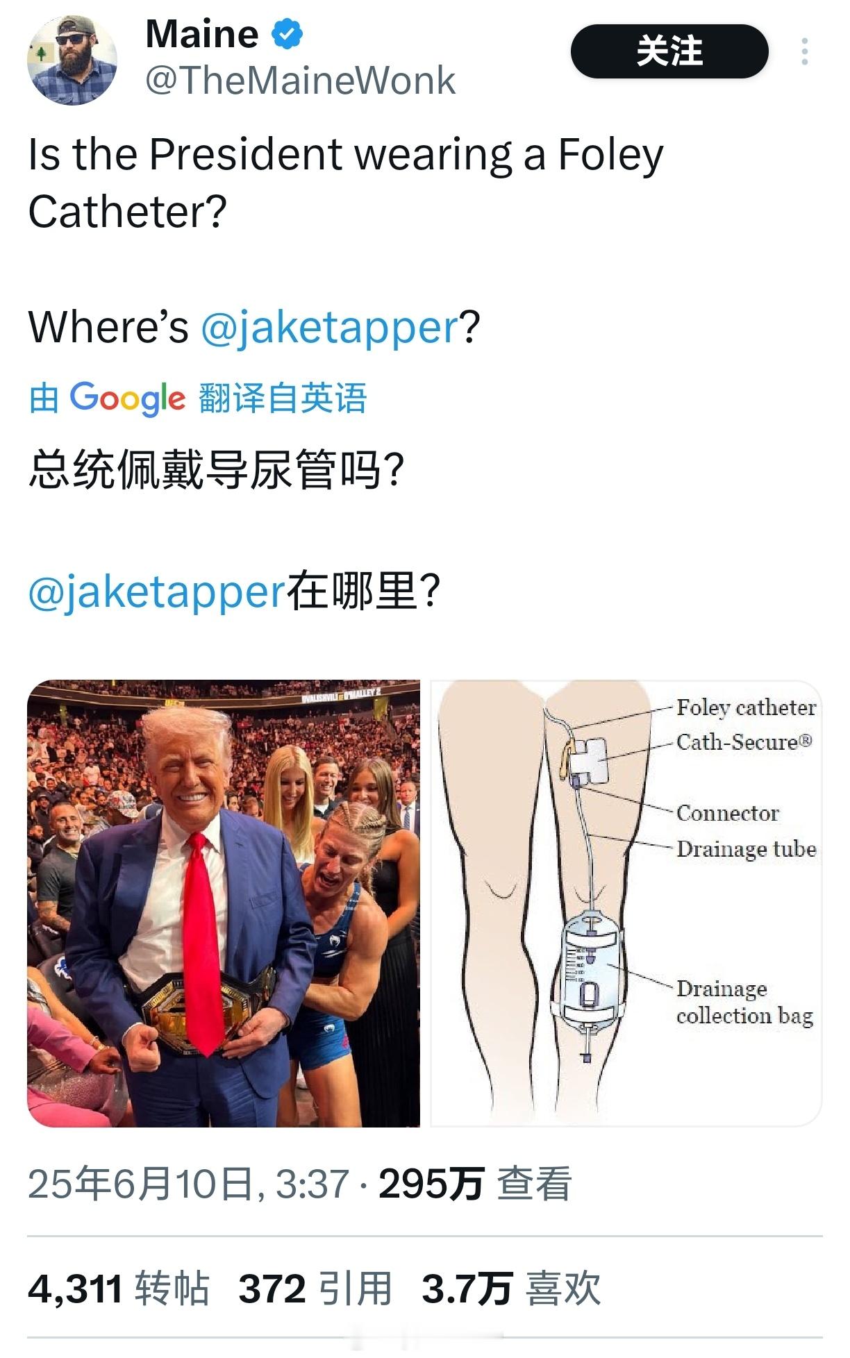 特朗普的腿这几天，特朗普的腿成为许多网民的谈资。​​​