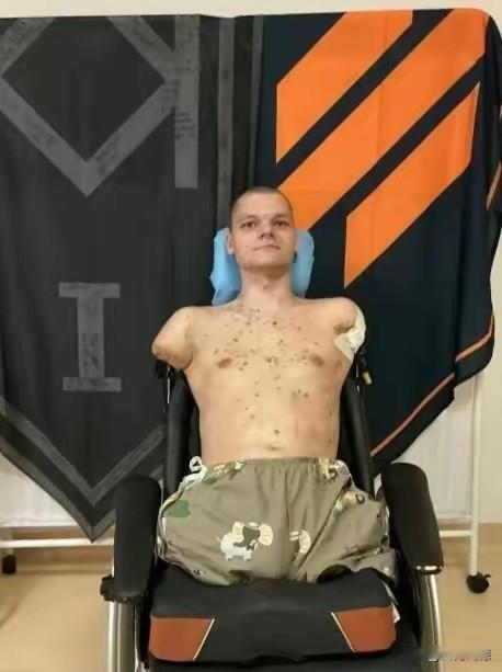 看到这名乌克兰士兵，失去了双腿，失去了双脚，这后半辈子可该怎么活呢？战争太残酷了