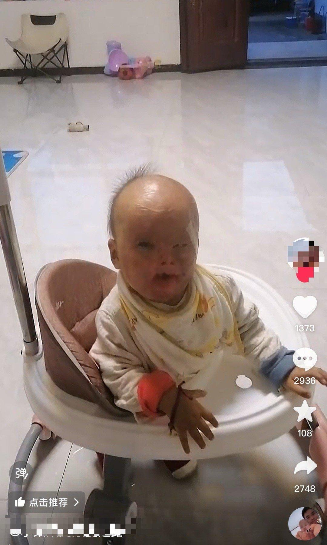 爹小儿麻痹二级残疾妈精神疾病二级残疾生了个娃吹风机放在床上对着孩子吹旁边