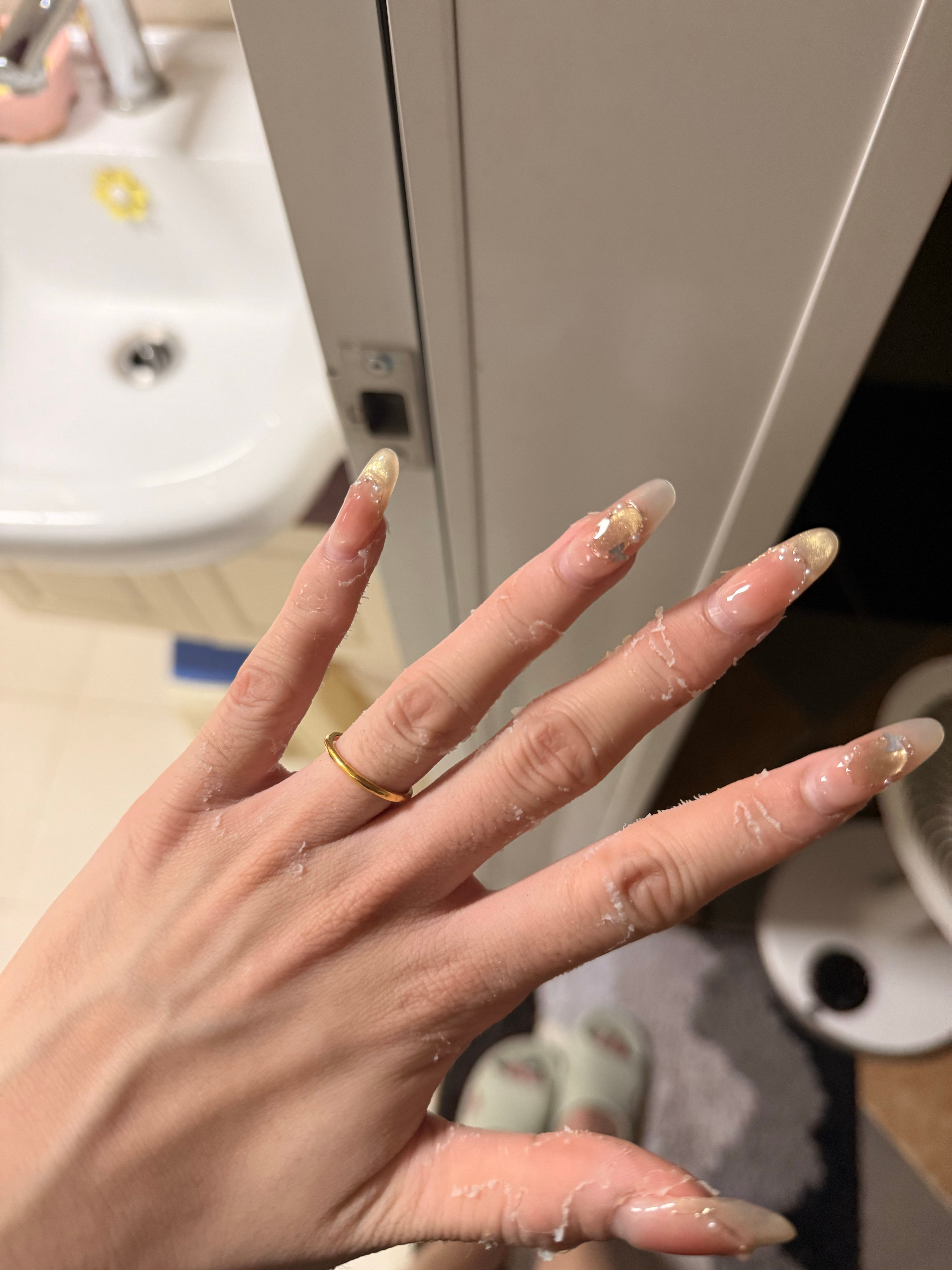 手这样掉皮是缺维生素吗不痒不痛就是掉皮[哭哭]​​​
