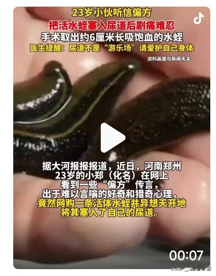 “是个狠人！”河南，一23岁小伙子因为好奇，把一只活体水蛭塞进了自己的尿道，谁知