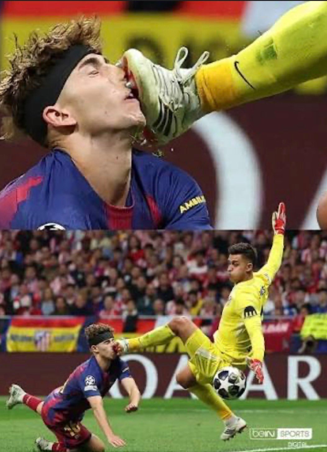 马竞门将穆索谈对费尔明·洛佩斯的踩踏时言辞坚定：这怎么可能是点球？绝对不可能