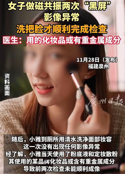 解释不清了！福建一29岁女生头晕，去医院做头颅磁共振。不料，连续2次扫描，都因面