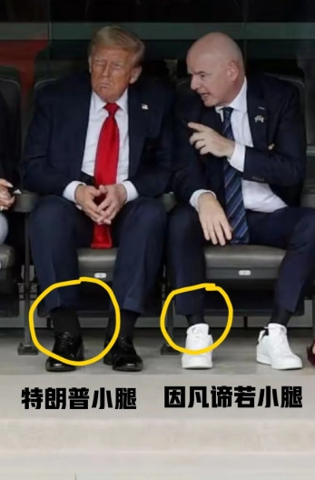 特朗普患病了，据白宫发言人说，特朗普患的是静脉曲张的病。从图一我们可以看出，他在