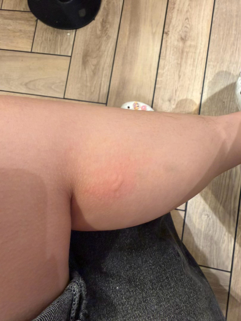 现在吃麦当劳害得献血啊给我咬3包