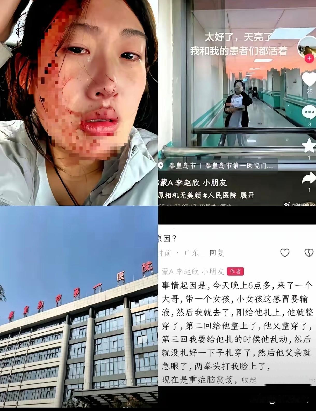 ​23岁女护士被打成重度脑震荡！为什么？给哭闹乱动的小女孩扎针，三次都因为孩