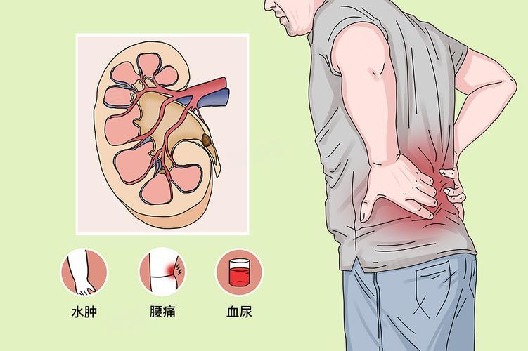 医生调查发现：慢性肾病人过了70岁，或有这4种现状，要坦然接受七十岁以后，身