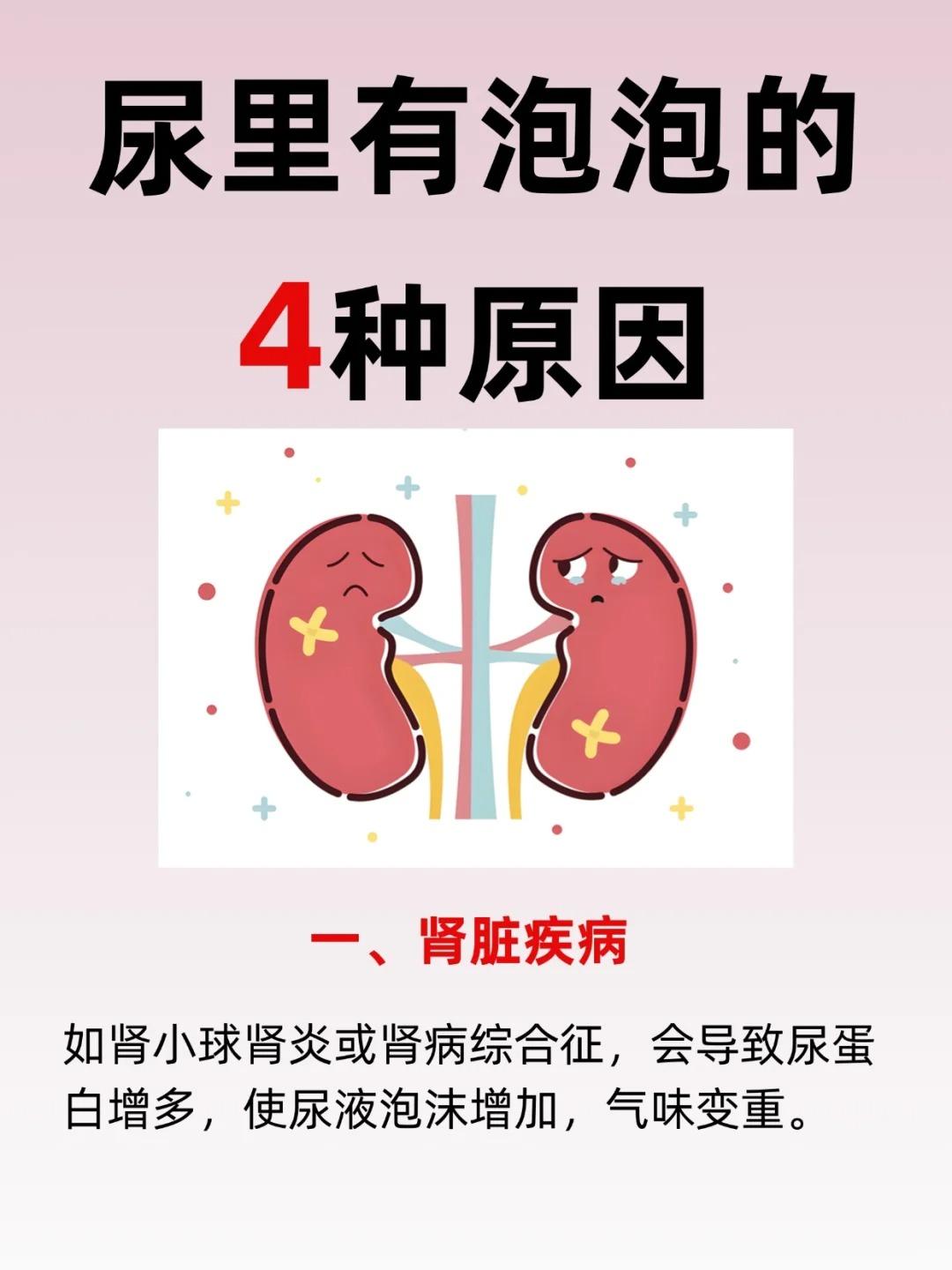 【尿里有泡泡？可能是这4种原因！】大家有没有这样的经历，上厕所的时候发