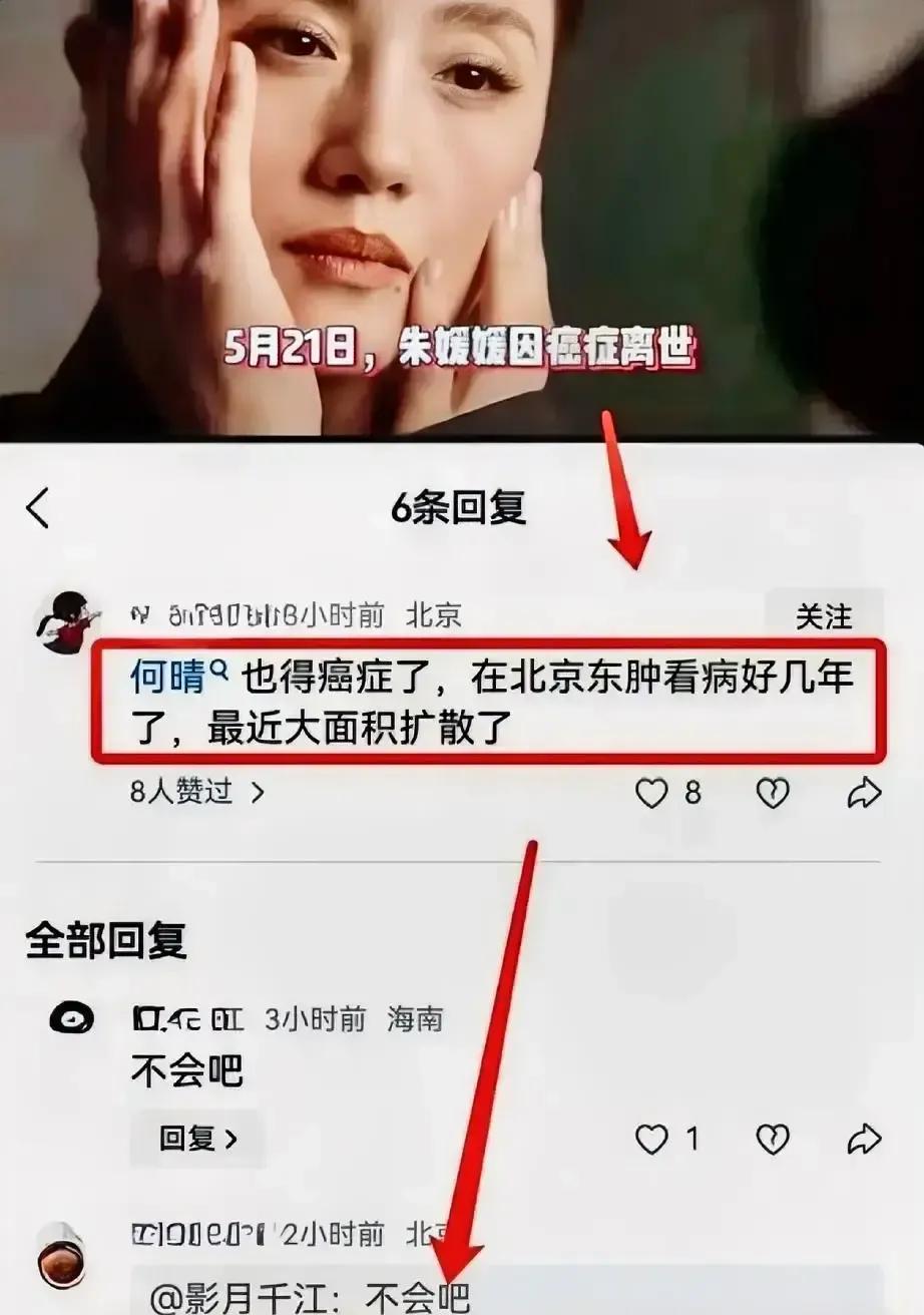 何晴用一场大病，捅破了娱乐圈最不敢说破的真相：片酬是按健康折旧算的。你以为她