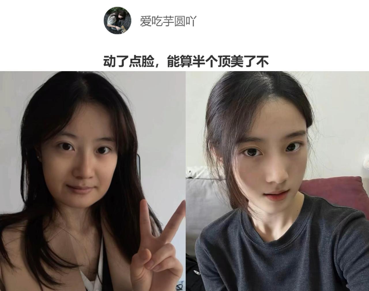 这位“美女”询问，她这小整了一下脸之后，现在算不算是半个顶美了？你们觉得呢？