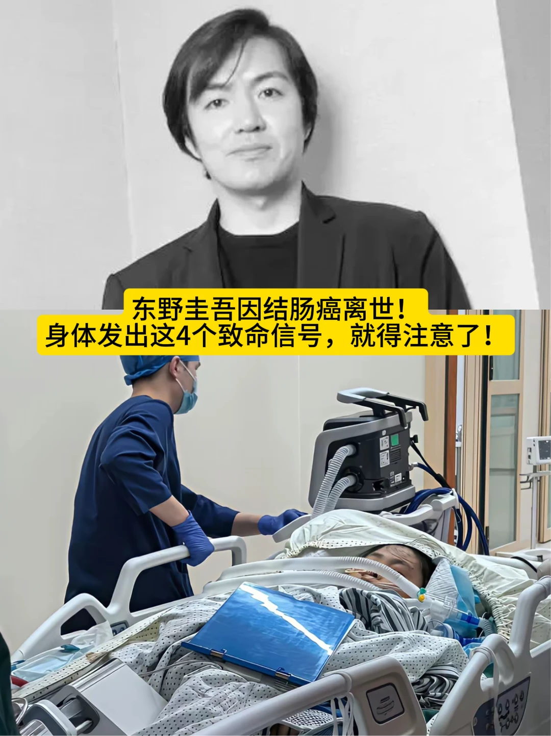 东野圭吾因结肠癌离世！注意结肠癌4大信号