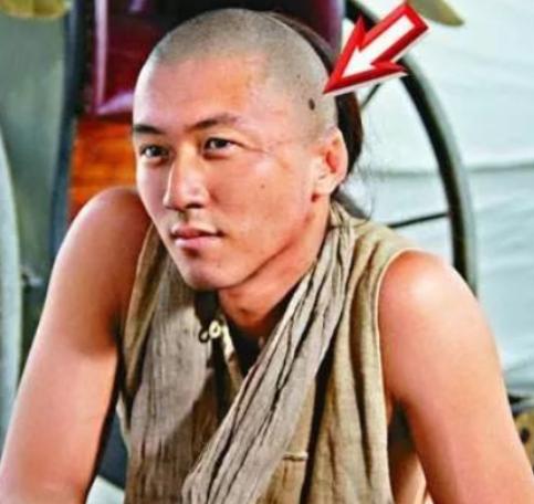 2012年，离婚不久，谢霆锋头部皮肤癌变，他打的第一个电话，既非王菲，亦非父母，