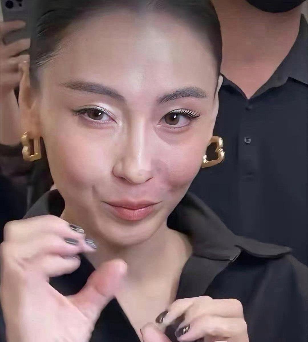 45岁的张柏芝皮肤还很好