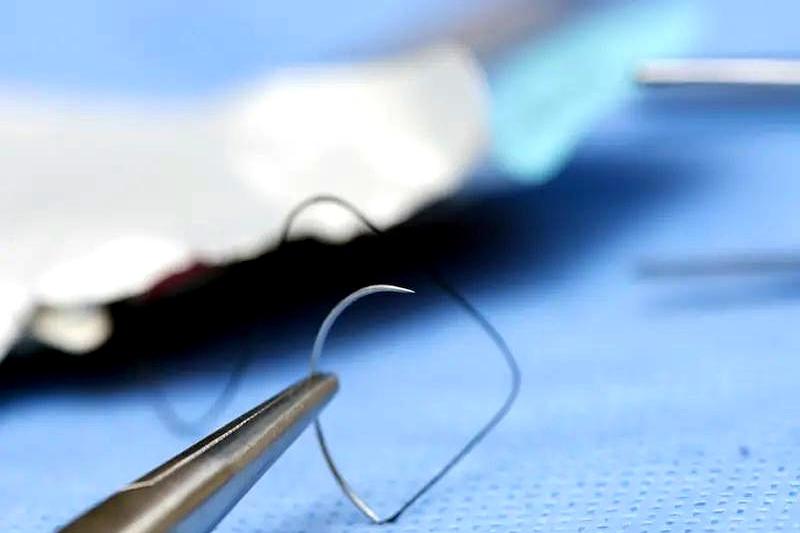 生完孩子有撕裂，医生说要缝针，这产妇死活不同意！从凌晨三点耗到天亮，谁劝都没用