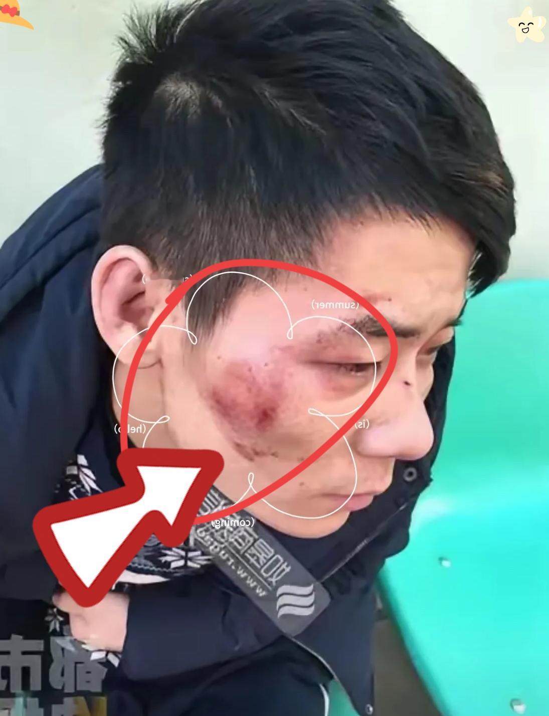 大半夜被人追打，直接往武警营门跑！这哥们儿算是把“绝境求生”玩明白了。5月1