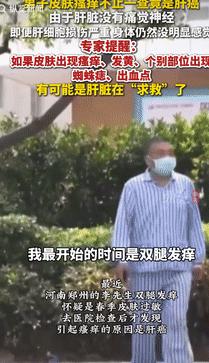 太吓人了！4月17日河南郑州，一男子的双腿有些痒，以为是普通的过敏，就去药店买了
