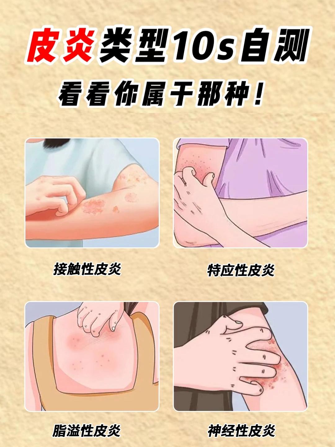 皮炎瘙痒夜难眠，中药十剂迎曙光！有人问我皮炎应该怎么治，答案是补益、清热、祛