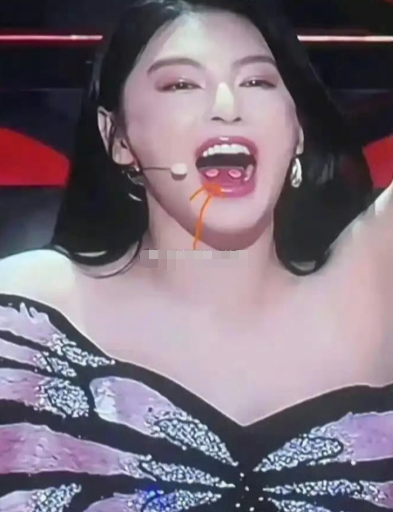 张雨绮嘴巴里这是什么东西？有人知道吗​​​