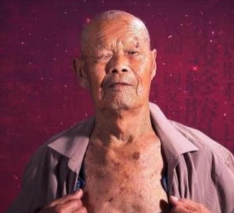 1956年，35岁农民咳嗽10年，竟拒绝就医，一天，他突然用力咳嗽，“哇”的一声