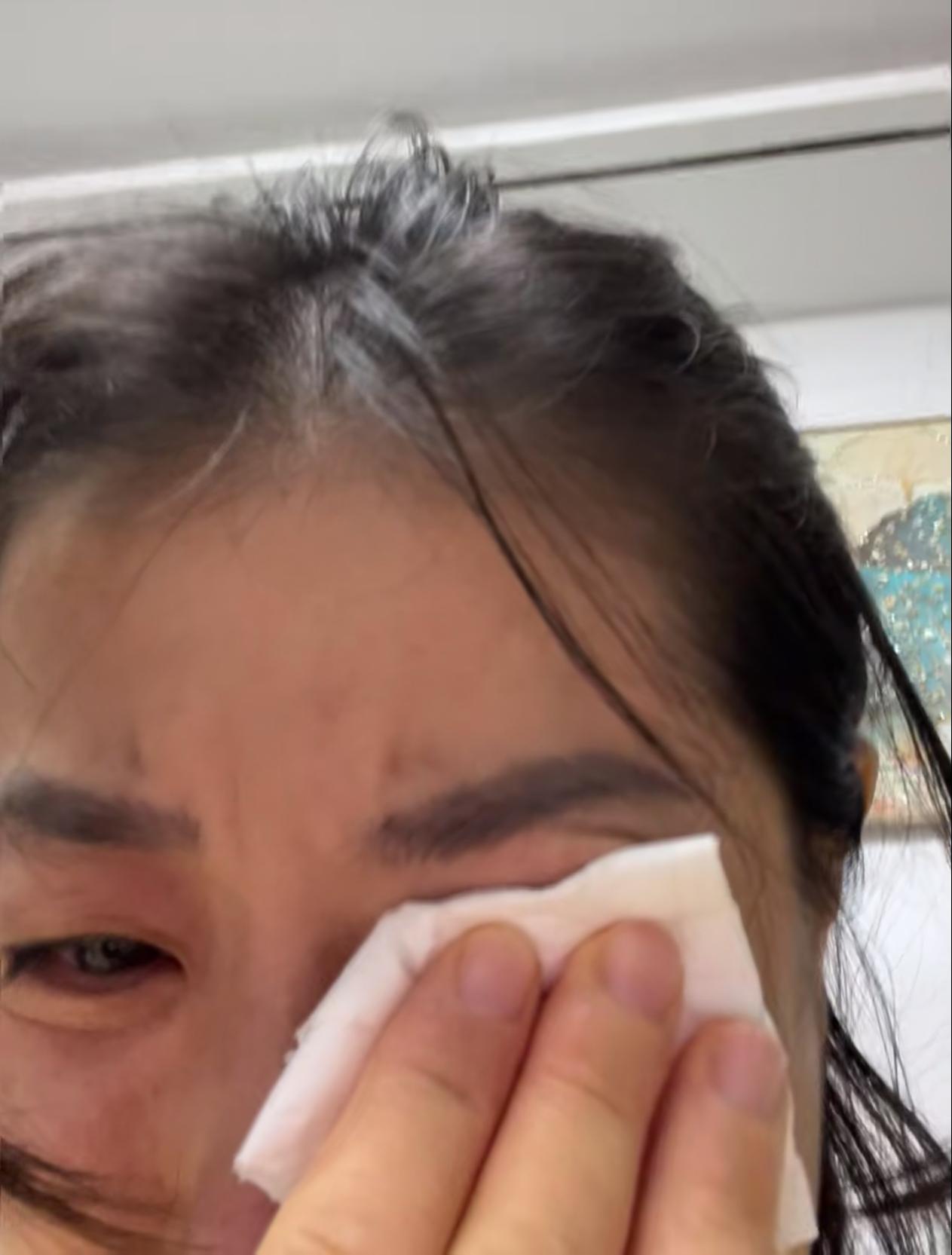 真是愁死了！我闺蜜是77年的，今年刚满50岁。年前还生龙活虎的，广场舞照跳