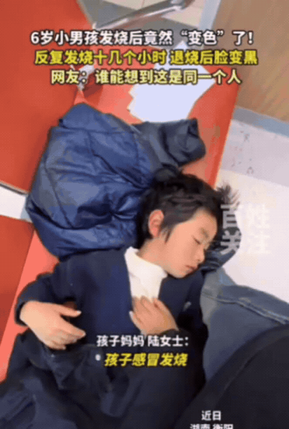 解释不清了！湖南一6岁小男孩突发高烧，好不容易退了烧，结果，本来白白净净的孩子，