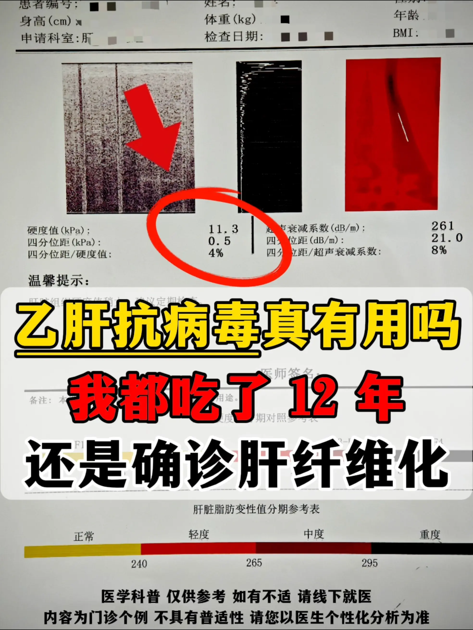 “我坚持吃了12年药，光吃药就花了5万块钱，但终究还是没逃脱肝纤维化...