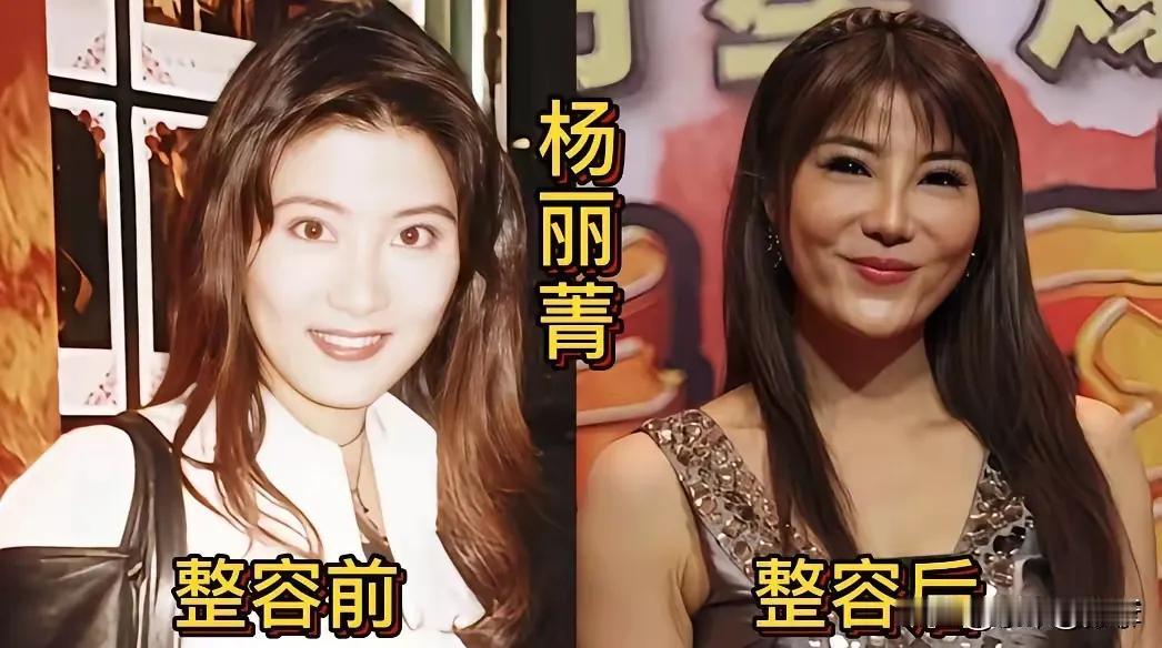 整容前的张萌。整容前的柳岩。整容前的熊黛林。整容前的杨丽菁。整容前的张