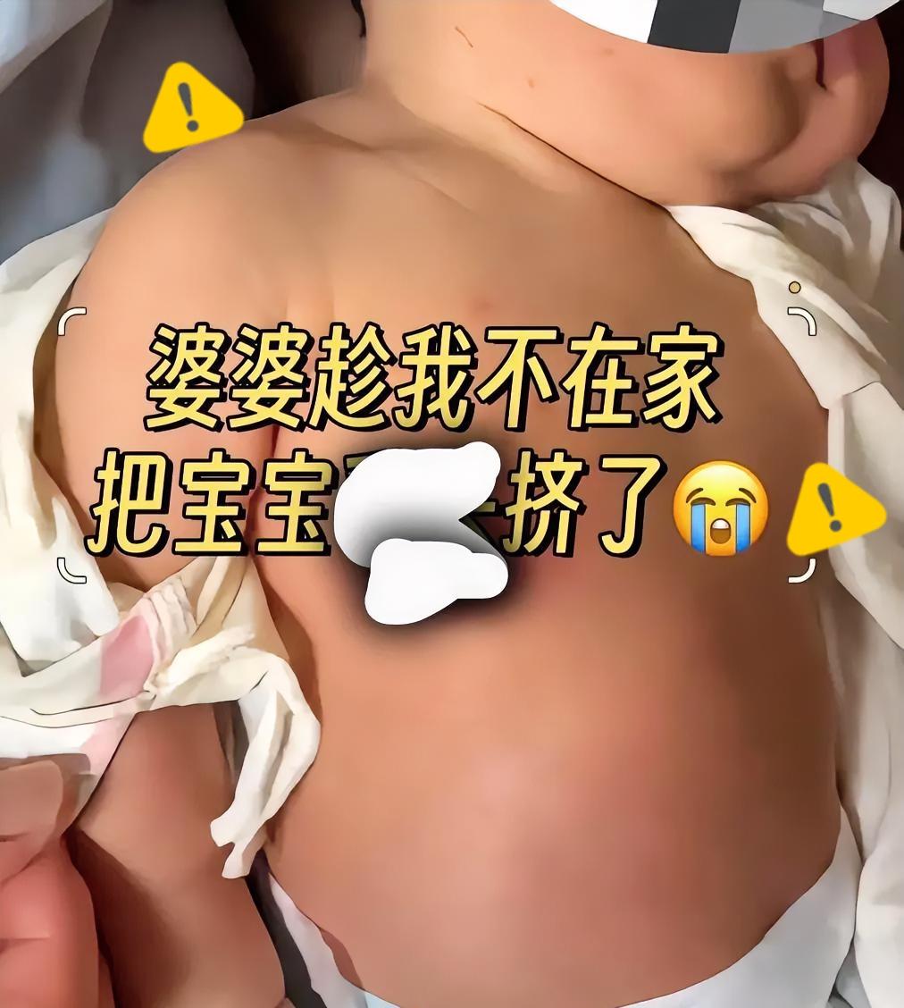 我真的要气哭了！家里老人居然趁我不在，偷偷去挤刚出生没多久宝宝的乳头！