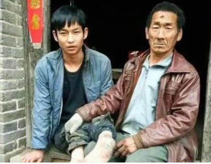 1991年，河南一对夫妇生下残疾儿子不愿抚养，就把孩子丢在草丛里，没想到，村里一