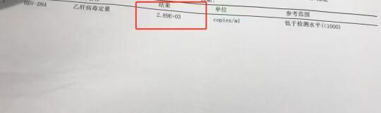 小三阳就不会对肝脏造成损伤了吗？这种情况还不能松懈，必须及时清除病毒...