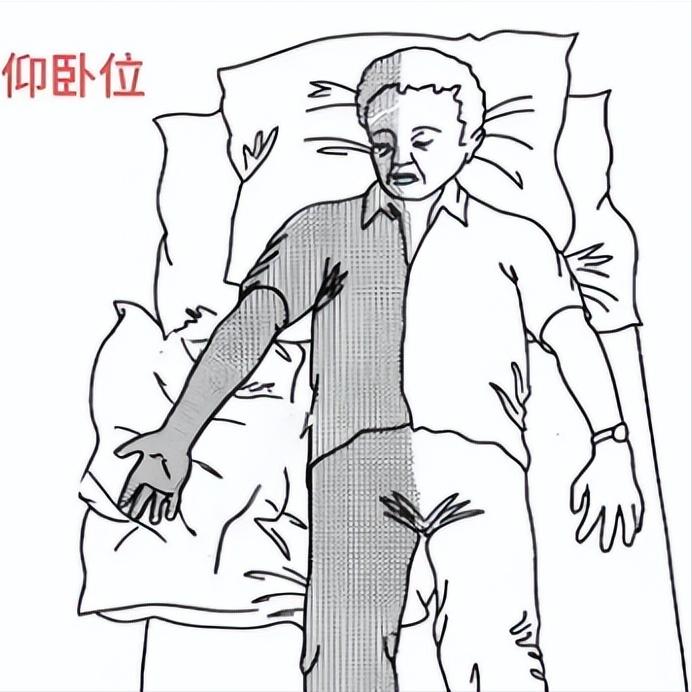 80%的偏瘫患者都不知道，康复的起点是姿势要对！ 在偏瘫患者的康复过程中，许