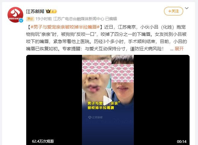 男子与狗亲吻被咬掉嘴唇和宠物亲昵，小心乐极生悲！江苏一小伙和狗狗“亲亲”