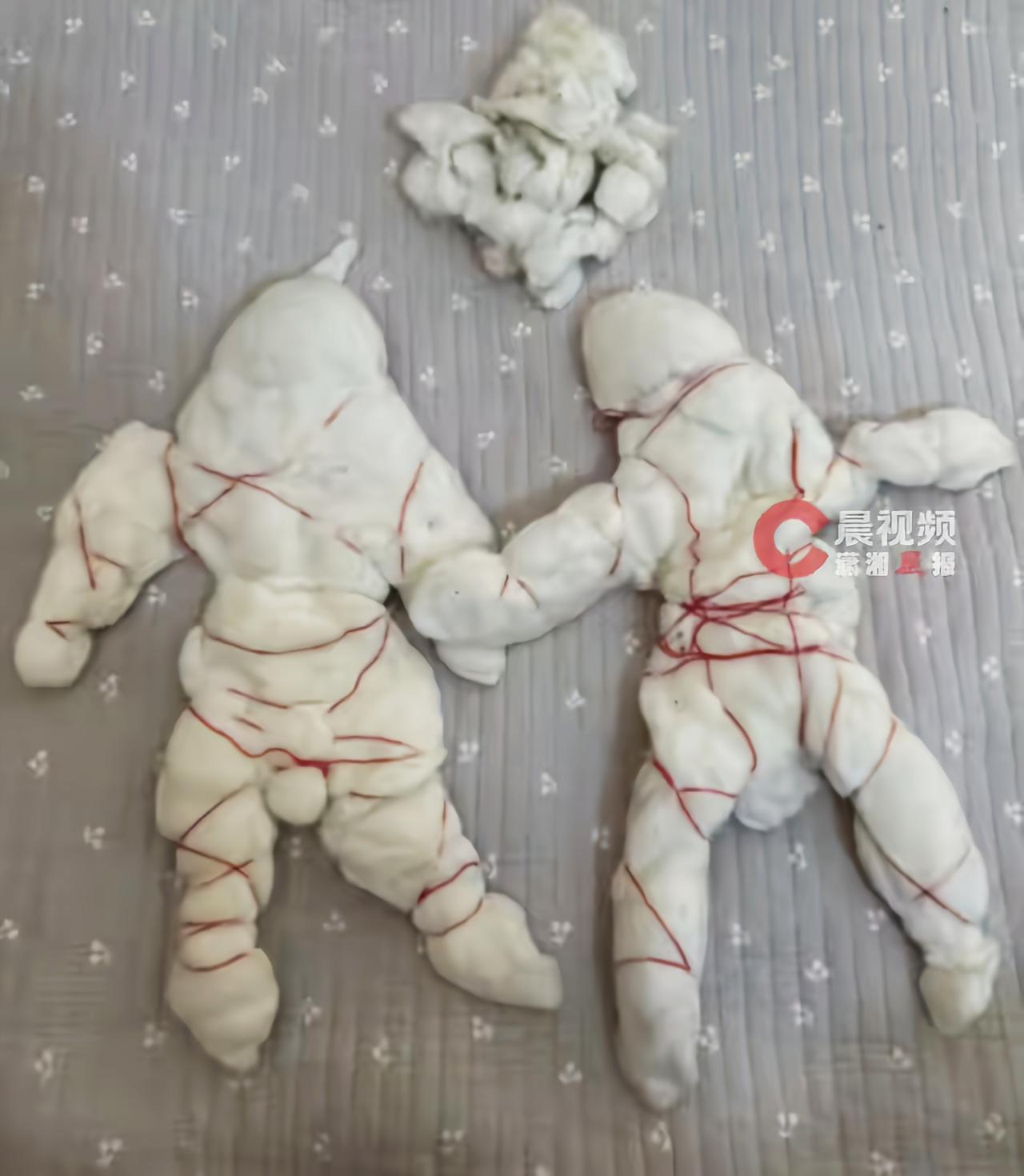 河南焦作，一名女子结婚九年，一直使用婆婆亲手缝制的新婚喜褥，从未拆开检查。今年生