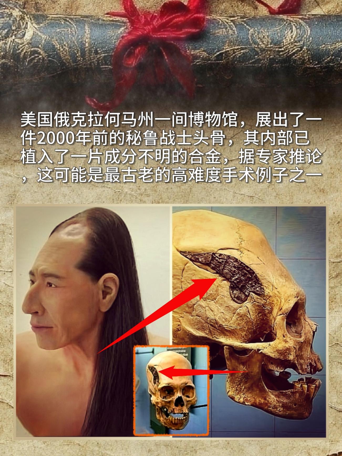 美国俄克拉何马州一间博物馆，展出了一件2000年前的秘鲁战士头骨，其内...