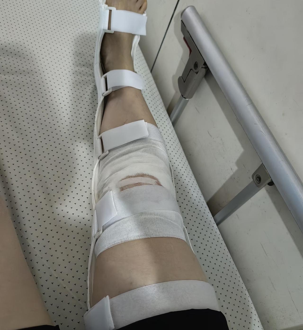 我搭同事的车出了车祸，在医院住了一个礼拜，同事要给我两万元私了，我没同意。同事出