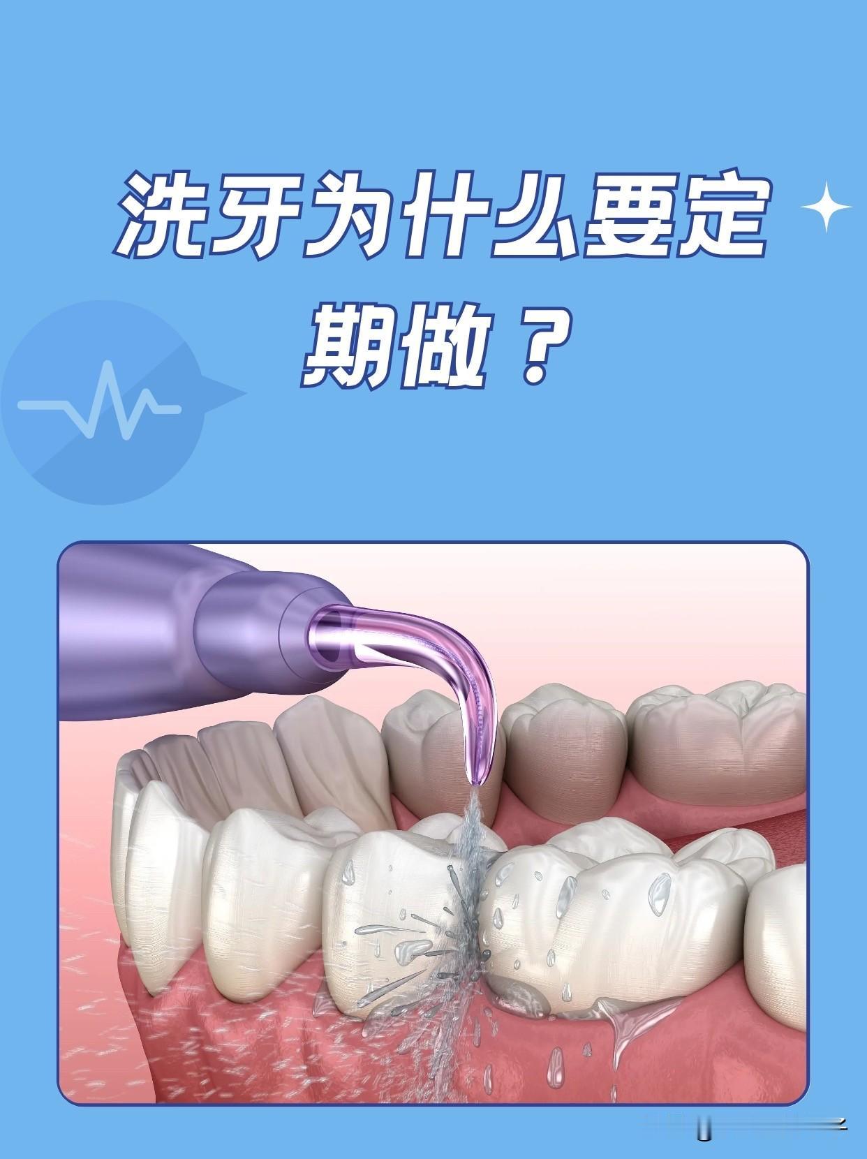 上周去洗牙，大夫问我怎么刷牙？我讲了一下！大夫要求：每年至少洗一次牙